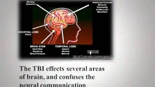 Afrit af Personal TBI story  Project HR