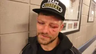 JOHN WAYNE HIBBERT REACTS TO HEARTBREAKING DEFEAT TO  SCARPA & QUESTIONS HANGING UP THE GLOVES
