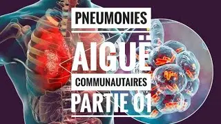 Pneumonies Aiguë Communautaires - partie 01 (Définition, Physiopathologie, Etiopathogénie)
