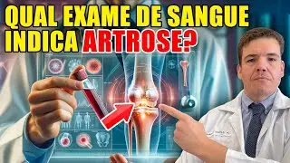 Exames de Sangue OBRIGAT&Oacute;RIOS para diagnosticar ARTROSE