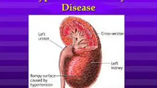 KIDNEY گردہ गुर्दा DISEASE PREVENTION 2  INFECTION  ICSP94 URDU HINDI BBJAN