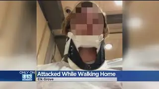 Students Beaten, Robbed By Teens Near Sheldon High School