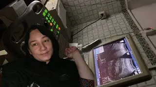 Ultrasound Kyu Krwani Parh Gai ? || Fatima Mirza || Photographer 📷