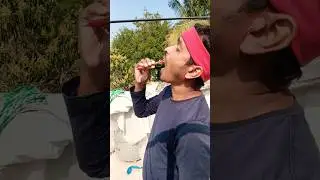 Cheek Side Magic Trick Gone Funny! 😂😱 | Hilarious Expression Twist by F-U-N-N-Y Netai😱😜