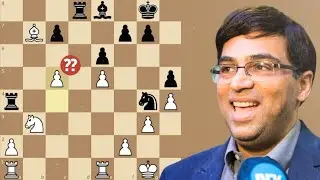 Vishy Anand Predicts Nepo&rsquo;s Huge Blunder!  Game 9 #CarlsenNepo