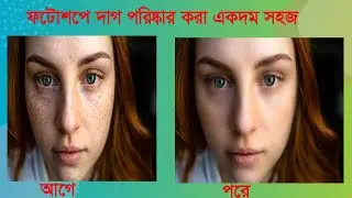 How to Quickly Smooth Skin and Remove dark Spot, Blemishes (Easily) : Photoshop Tutorial