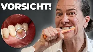 Schlimmer Fehler: Falsche Putztechnik mit fatalen Folgen (Verursacht Schmerzen)