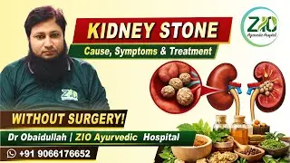 Kidney Stone Treatment Without Surgery | Causes, Symptoms & Cure by Dr. Obaidullah Sab