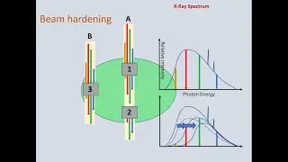 CT Basics Lesson 12
