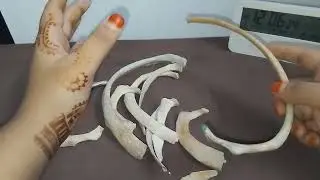 Classification Of Ribs || Demo 5