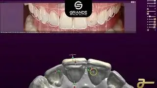 Digital Smile Design 3D