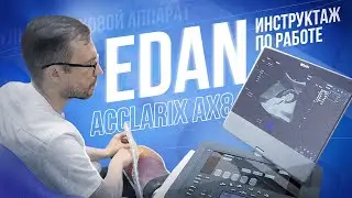 Инструктаж по работе на топовом портативном УЗИ аппарате Edan acclarix ax8 💥