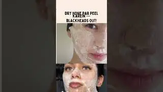 #EggWhiteMask  #BlackheadPeel  #RomanUrduTips  #DIYFacePack  #SkincareTotka  #PoreCleaningHack