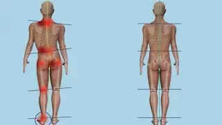 Leg length discrepancy; one leg is shorter than the other