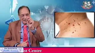 పులిపిరి కాయలలో రకాలు Dr Samaram's Vasavya Health Care : Mee Intlo Meere Doctor (87)