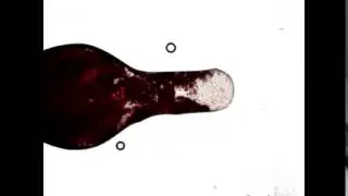 Plasma and Blood Cells Separation with Digital