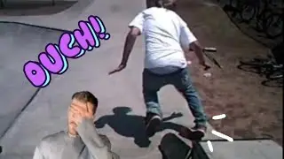 Hunter brakes his ankle at weston skatepark