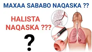 🛑 Maxaa sababa naqaska ( causes of dyspnea )--- 9-- sheey oo sababta naqaska....