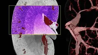 High contrast 3D histology demonstrated with sandpaper X-ray technique