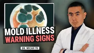 What Mold Toxicity Does to your Health and How to Treat It
