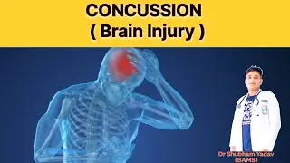 Concussion in Hindi || Brain injury || #concussion 