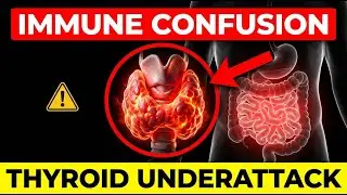Top Endocrinologist Reveals Hidden Gut Health Link to Thyroid Problems After 40