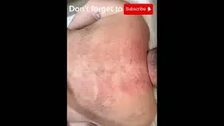 Deep Back Therapy&ndash; Strength Meets Relief #deepbackmassage #intenseasmr #strongtouch #massageasmr