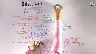 Osteoporosis in Urdu\Hindi | Biomechanics of human bone growth and development