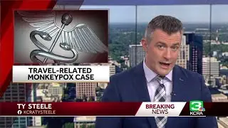 Monkeypox &lsquo;likely&rsquo; in Sacramento County patient who recently traveled to Europe, health officials...