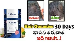 man matters hair gummies review in telugu | william tech and life