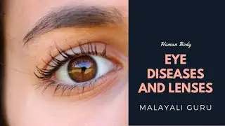 Eye diseases||Important questions||Human Body||