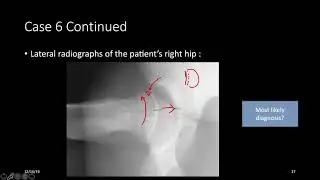 Step 2CK Lesson 7 - Musculoskeletal (MSK) Case Review Part 2