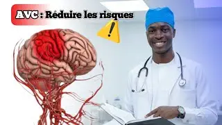 Prévenir l’AVC : Votre guide complet 🧠