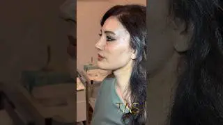 She had 2 failed facelift with someone else and she is a wife of plastic surgeon. #drsuleymantas