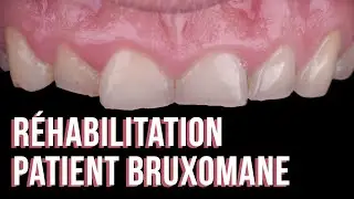 R&eacute;habilitation d'un patient bruxomane