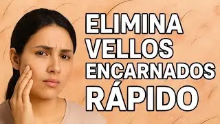 Este m&eacute;todo elimina los vellos encarnados M&Aacute;S R&Aacute;PIDO que cualquier crema 😳✨
