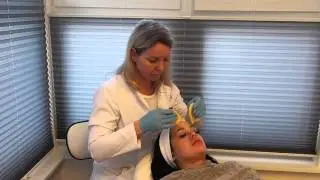 Dermapen &ndash; Collagen Induction Therapy