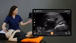 Femur Length Measurement