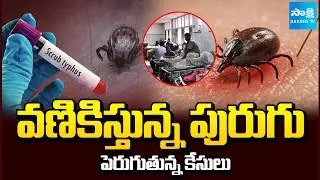 Scrub Typhus Cases Increasing in Andhra Pradesh | AP Virus News | Sakshi TV