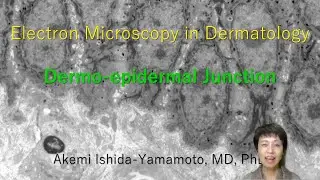 Electron microscopy in Dermatology. Dermo-epidermal Junction
