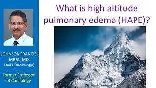 What is high altitude pulmonary edema (HAPE)?