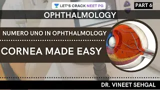 Numero Uno in Ophthalmology: Cornea made Easy | Part-6 |Ophthalmology | NEET-PG 2021 | Vineet Sehgal
