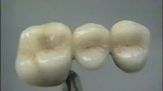Ivoclar