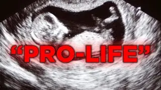 Brain Dead Woman Forced To Stay On Life Support For 9 Week Old Fetus