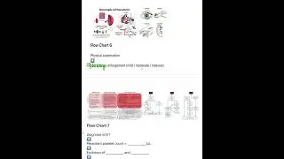 Essential thrombocythemia
