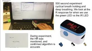 Development of a PPG Sensor Array as a Wearable Device to Monitor Cardiovascular Metrics