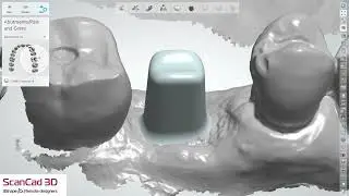 3shape 10-21-2025 K ab