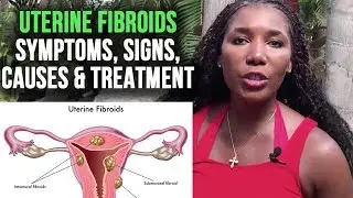 Uterine Fibroids Symptoms, Signs,  Causes and Treatment