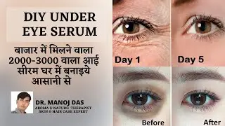 DIY for DARK CIRCLES, WRINKLES & PUFFINESS | Most Affordable & Results in 2 Weeks I DR. MANOJ DAS