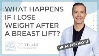 What happens if I lose weight after a breast lift?